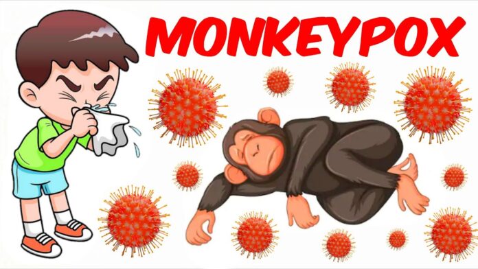 Monkey Pox Disease